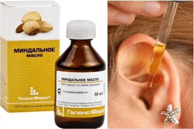 Лечение ушей маслами. Препараты для закапывания в уши. Препараты от боли в ухе. Миндальное масло для ушей.