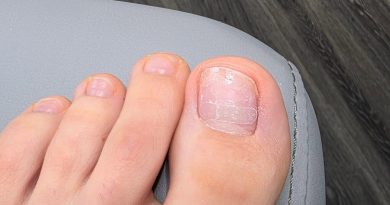 Может ли коррекция ногтей быть невидимой, да)